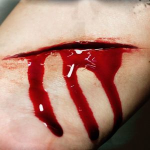 Slash Prosthetics- Tinsley Transfers